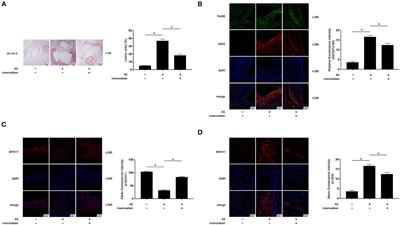 Rivaroxaban Suppresses Atherosclerosis by Inhibiting FXa-Induced Macrophage M1 Polarization-Mediated Phenotypic Conversion of Vascular Smooth Muscle Cells
